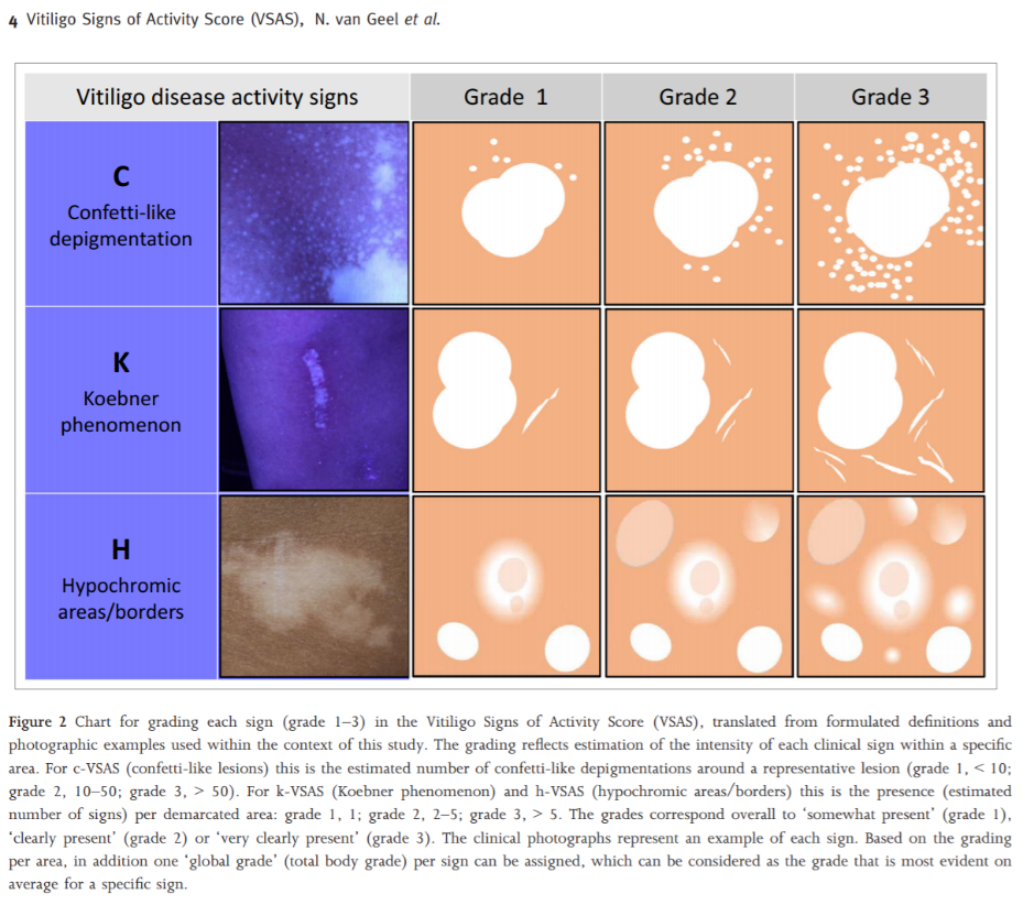 vitiligo-signs-of-activity-score-2